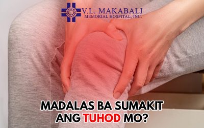 Madalas Ba Sumakit Ang Tuhod Mo?