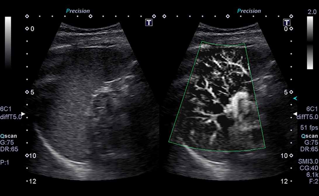 Ultrasound Machine Result