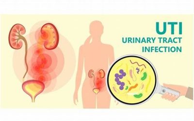 Urinary tract infection (UTI)