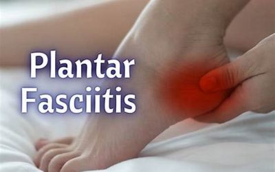 Plantar Fasciitis: Steps to Remedy a Common Foot Health Concern