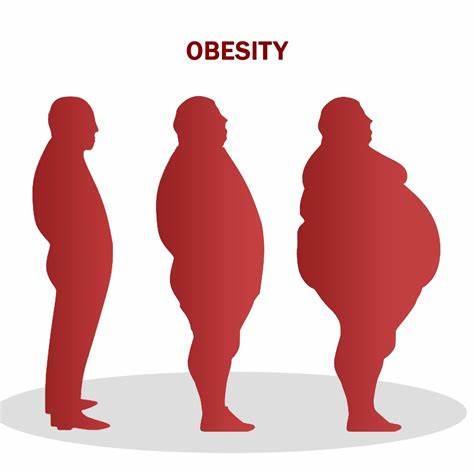 Obesity | V.L. Makabali Memorial Hospital, Inc.