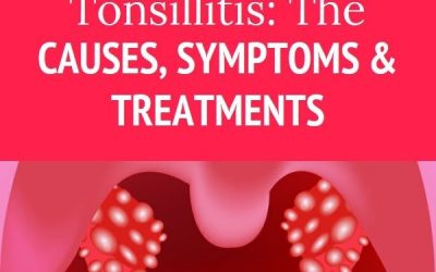 Tonsillitis, cause, symptoms and treatment?