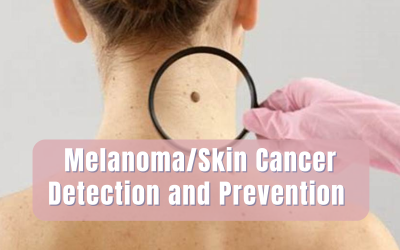 Melanoma/Skin Cancer Detection and Prevention?