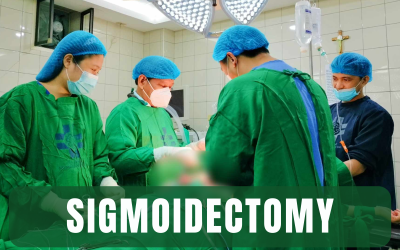 Sigmoidectomy?