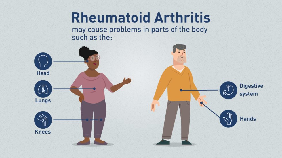 Managing and preventing the progression of Rheumatoid Arthritis (RA ...